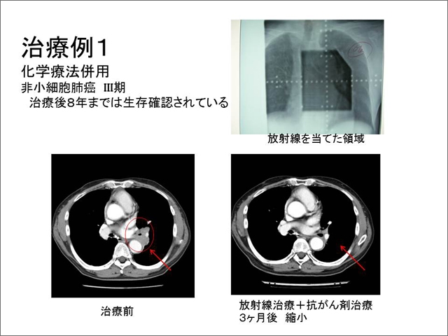 核磁気共鳴画像装置（ＭＲＩ） 