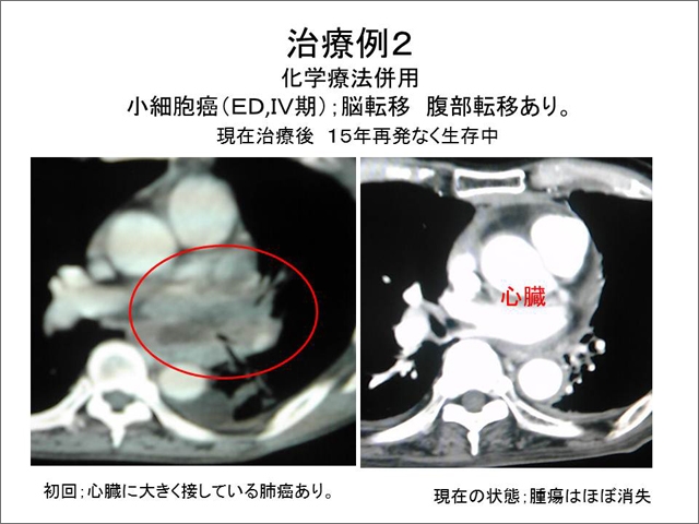 核磁気共鳴画像装置（ＭＲＩ） 